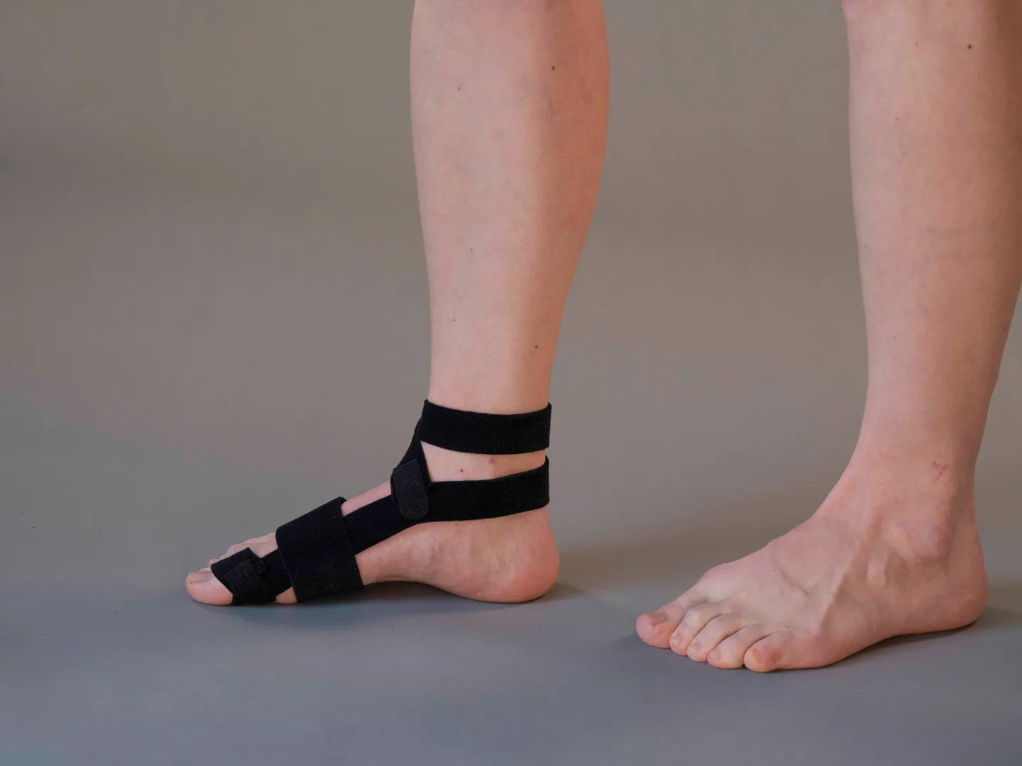 Kallassy NRX Hallux Valgus-Kit Strap